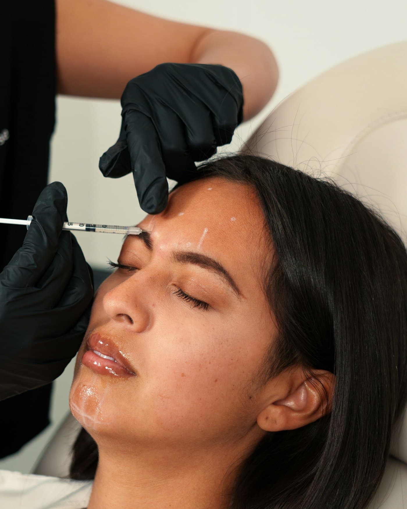 Anti-Wrinkle Injections