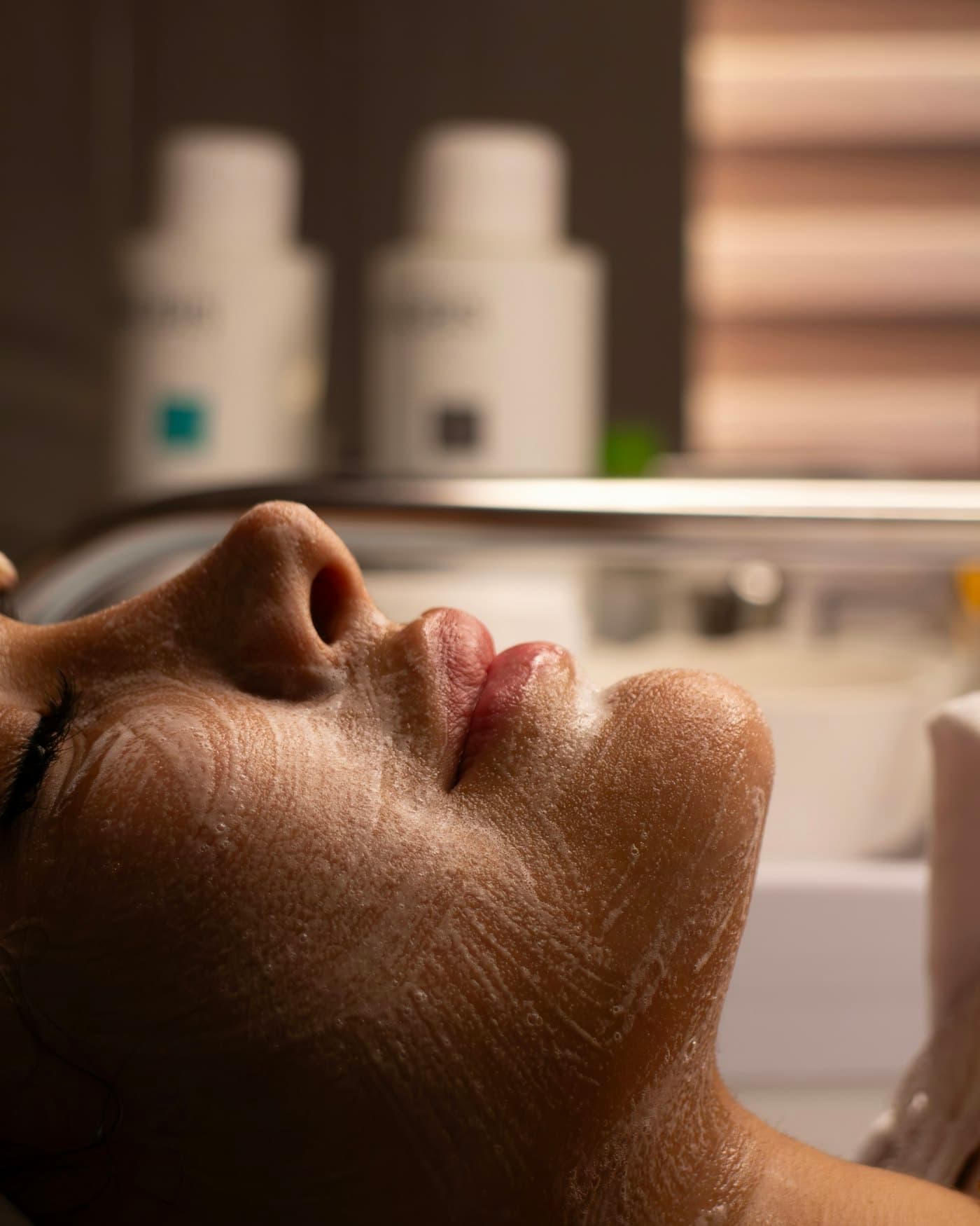 Chemical Peel
