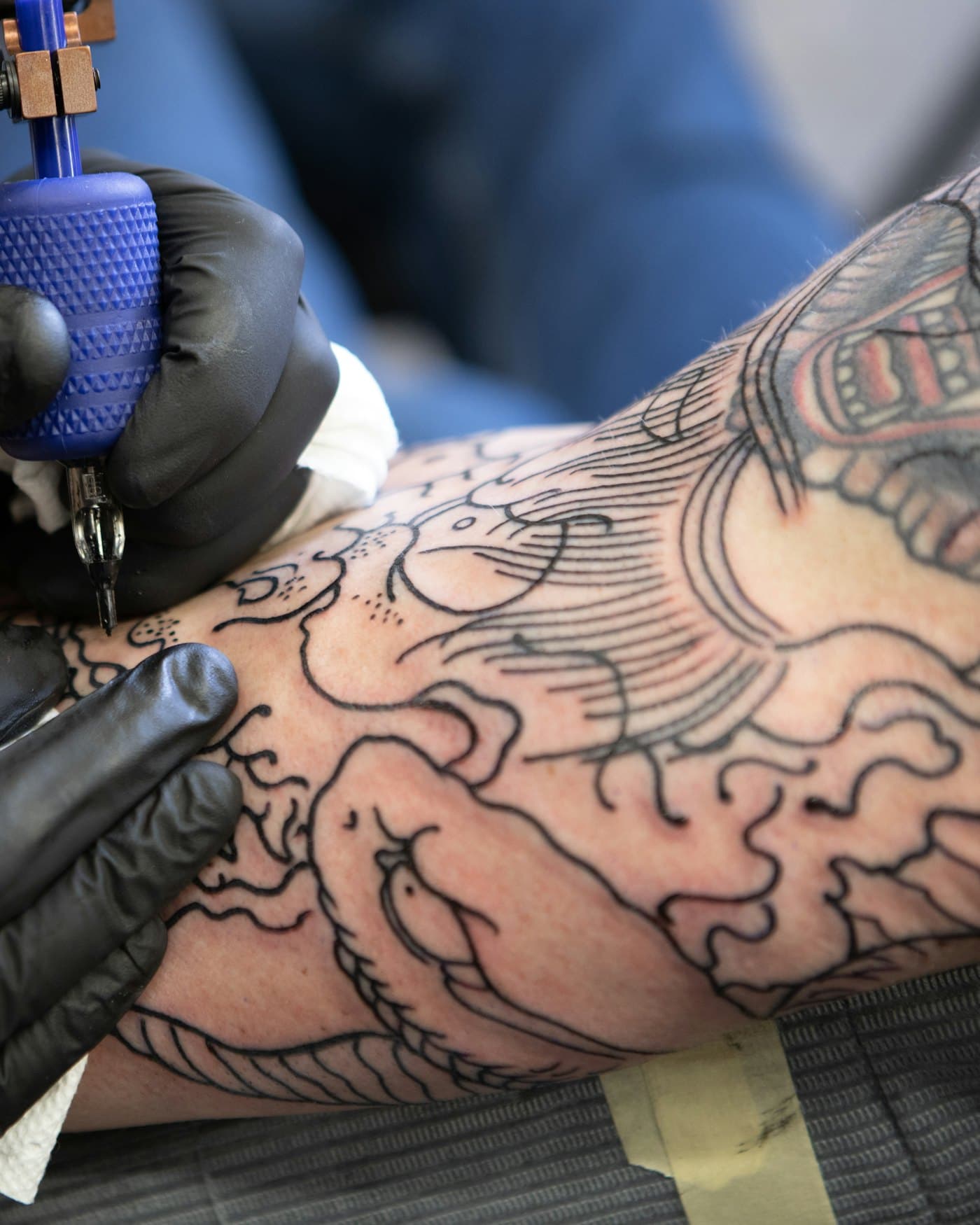Laser Tattoo Removal
